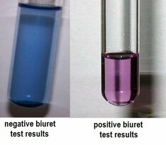 Biuret's test for proteins